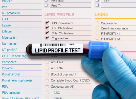 Symbolbild einer Blutprobe mit Beschriftung Lipid Profile Test